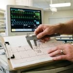 Healthcare provider measuring intervals on an EKG rhythm strip with calipers